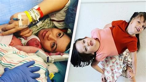 we live together nicole|Conjoined twins who were given 24 hours to live are thriving .